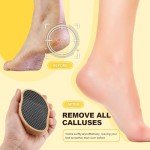 Nekoo Callus Remover Foot File and Scrubber
