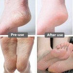 Stainless Steel Dual-Sided Foot File and Rasp