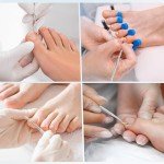 6-Piece Ingrown Toenail Treatment Tool Kit