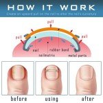 Ingrown Toenail Treatment & Corrector Tool