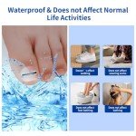 Titanium Alloy Ingrown Toenail Correction Kit