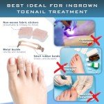 Ingrown Toenail Treatment & Corrector Tool