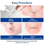 Titanium Alloy Ingrown Toenail Correction Kit