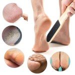 Dimeho 2-Pack Foot File Callus Remover Tools