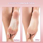 80 Pcs Stainless Steel Foot File Replacement Pads