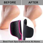 Beomeen Curved Foot File - 2 Pack Callus Remover