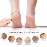 2 Pack Wooden Handle Foot Rasp Callus Remover