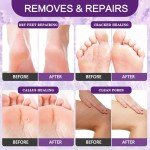 Foot Callus Remover Gel and File Kit
