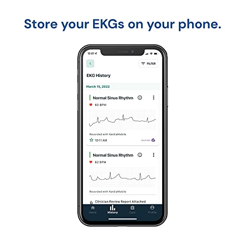 KardiaMobile EKG Monitor – AFib Detection in 30s