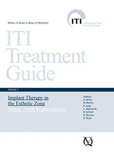 Implant Therapy in the Esthetic Zone: Single-Tooth Replacements (ITI Treatment Guide Series Book 1)