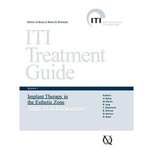 Single-Tooth Replacement Guide for Implant Therapy