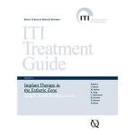 Single-Tooth Replacement Guide for Implant Therapy
