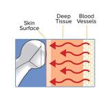Adtemp 427 Temporal Contact Thermometer LCD Display 427 1 Each