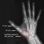 Cool Comfort Thumb Support Brace for Arthritis