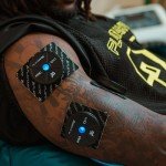 iReliev Wireless TENS & EMS Pain Relief System