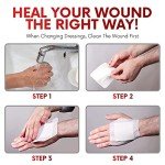 HEALQU Island Dressing - 4"x4", 30 Count - Bordered Gauze Sterile Individually Wrapped Gauze Pads, Water-Resistant, Non-Woven Backing - Soft and Breathable Wound Dressing for First Aid and Medical