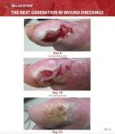 SilvrSTAT First Aid Kit Gel | 32 PPM Silver Healing Wound Dressing Gel | SilverSol Ag₄O₄ Particles | 1 oz