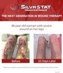 SilvrSTAT First Aid Kit Gel | 32 PPM Silver Healing Wound Dressing Gel | SilverSol Ag₄O₄ Particles | 1 oz