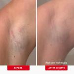 Organic Ingrown Hair Treatment Pads with BHA & AHA