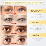 Nazano 24K Gold Under Eye Patches - 60 Pcs