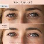 Joseon Revive Eye Serum for Dark Circles & Puffiness