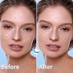 Daolyo Acne Patches with Salicylic Acid & Tea Tree
