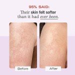 First Aid Beauty - KP Bump Eraser Body Scrub with 10% AHA, Keratosis Pilaris Skin Exfoliator with Glycolic and Lactic acids, Helps Reduce Chicken Skin Bumps, Safe for Sensitive Skin, 2 oz