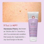 First Aid Beauty - KP Bump Eraser Body Scrub with 10% AHA, Keratosis Pilaris Skin Exfoliator with Glycolic and Lactic acids, Helps Reduce Chicken Skin Bumps, Safe for Sensitive Skin, 2 oz