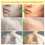 Bee Venom Hydrating Spray for All Skin Types