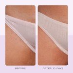 Organic Ingrown Hair Treatment Pads with BHA & AHA