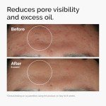 The Ordinary Niacinamide & Zinc Serum for Blemishes