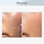 TOSOWOONG Niacinamide 15 Face Serum, 150,100ppm Niacinamide, Tranexamic acid, Dark Spot Corrector, Glass Skin, Radiant Complexion, Pore Minimizer, Even Skin Tone, Korean Skin Care, 30ml, 1.01 fl.oz