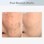 TOSOWOONG Niacinamide 15 Face Serum, 150,100ppm Niacinamide, Tranexamic acid, Dark Spot Corrector, Glass Skin, Radiant Complexion, Pore Minimizer, Even Skin Tone, Korean Skin Care, 30ml, 1.01 fl.oz