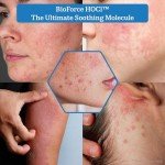 NueVue BioForce Pure Hypochlorous Acid Spray For Face & body - Rescues Acne-Prone Skin & Eczema, Piercing aftercare, Tattoo Aftercare, 100% Canadian Made, All-in-One Gentle Skin Cleanser & Toner, Natural Saline Solution, pH Balanced, Non-comedogenic (8.2 oz)