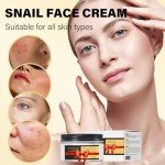 Snail All in-1 Cream, Snail Moisturizer Face Cream For Women, Hydrating Face Cream For Dry Skin, Daily Face Moisturizer, 100g / 3.52 Oz