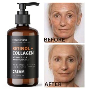 Retinol Collagen Hyaluronic Acid Anti-Aging Serum 4oz