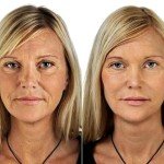 Retinol Collagen Hyaluronic Acid Anti-Aging Serum 4oz