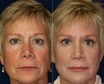 Retinol Collagen Hyaluronic Acid Anti-Aging Serum 4oz