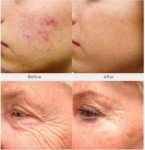 Retinol Collagen Hyaluronic Acid Anti-Aging Serum 4oz
