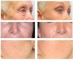 Anti-Aging Serum with Retinol and Vitamin C