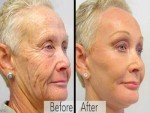 Anti-Aging Serum with Retinol and Vitamin C
