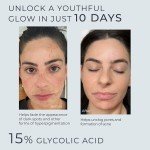 15% Glycolic Acid Face Serum - 2oz Size