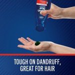 Selsun Blue Medicated Antidandruff Shampoo, Maximum Strength Scalp Treatment With Selenium Sulfide, 11 fl. oz.