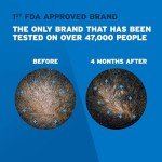 Men's Rogaine 5% Minoxidil Foam for Hair Regrowth, Topical Hair Loss Treatment for Men to Regrow Fuller, Thicker Hair, Unscented Minoxidil Topical Aerosol, 3-Month Supply, 3 x 2.11 oz