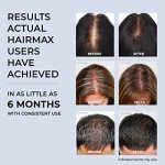 HairMax Laser Band 41 - (FDA Cleared) Hair Growth Device - Restores Natural Hair Cycle with Red Light Therapy