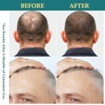 Natural Hair Growth Oil Spray: Batana Rosemary Serum Biotin Caffeine Scalp Care Treatment - Thinning Hair Regrowth Thickening for Women Men 2 FL OZ