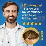 Minoxidil Liquid Extra Strength Hair Regrowth Treatment for Men, 5% Topical Solution, 6 Months Supply - Dropper Applicator and Bonus Free Instructional Guide Included