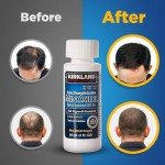 Minoxidil Liquid Extra Strength Hair Regrowth Treatment for Men, 5% Topical Solution, 6 Months Supply - Dropper Applicator and Bonus Free Instructional Guide Included