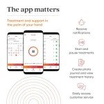 REVIAN Red Cap Hair Growth Device LED Wireless FDA Cleared Red Light Therapy for Hair Regrowth, Hair Loss Treatment for Men + Women, Thinning, Regrowth & Alopecia with Smartphone App