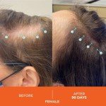 DS Laboratories Revita Hair Growth Conditioner for Fine & Thinning Hair, Biotin Treatment for Hair Regrowth, Thickening & Loss Prevention